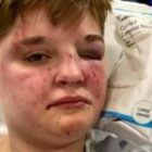 Lesbian teen brutally beaten at Illinois McDonald’s